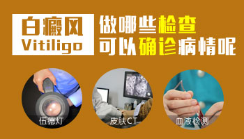 儿童脸上有大面积白斑只吃药不照光能好吗