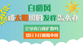 儿童脚部长白癜风照308激光多长时间有好转