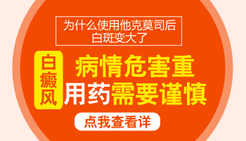 儿童肩膀巴掌大白斑做308激光照多长时间合适