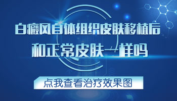 孩子身上长白癜风照308激光2次不见效怎么办