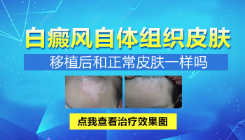 孩子身上突然白一块照308激光2次不见效怎么办