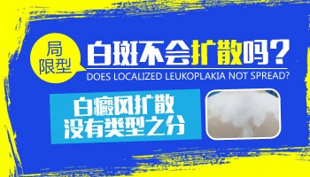 长白癜风快半年还没控制住怎么办