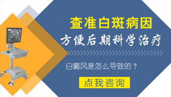 儿童后背长白癜风做308激光照多长时间合适