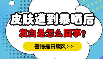 9岁男童长白斑远大3个月治好