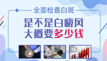 婴儿身上长白点只照308激光能好吗