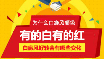 儿童腰部巴掌大白斑只照308激光能控制住吗