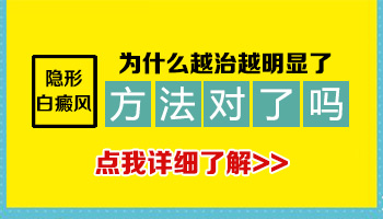 扩散的白癜风照uvb能控制扩散吗