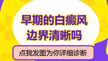 儿童眼处巴掌大白斑怎么治疗有康复案例吗