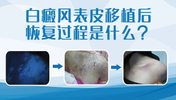小孩身上长硬币大白斑照激光一次需要多久