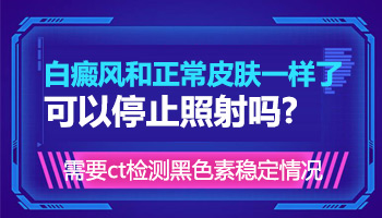 小孩泛发型白癜风初期怎么治不扩散