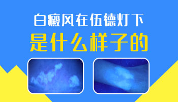 婴儿身上出现小白块怎么治没有副作用