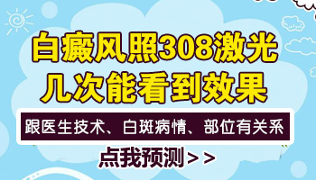 孩子身上有米粒大白点只照308激光能好吗