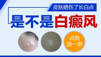 儿童脚部有白点照308激光能治好吗