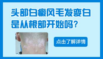 孩子身上有片白照308激光多长久有好转