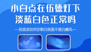 儿童胸部有白块在变大该怎么办