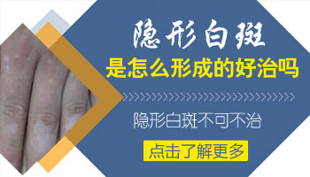 婴儿身上长米粒大白点怎么治疗正规