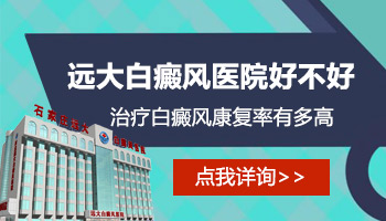 小孩身上发现米粒大白斑照激光一次需要多久