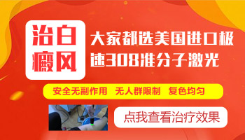 儿童下巴长白癜风在变大该怎么办